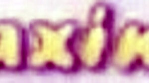 Anal Expert Dr Maxine Probes Vicky Vette's Tight Butthole