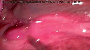 my amateur experience tracking pink area changes 172 days post first intimate moment