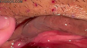 my amateur experience tracking pink area changes 172 days post first intimate moment