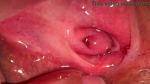 my amateur experience tracking pink area changes 172 days post first intimate moment